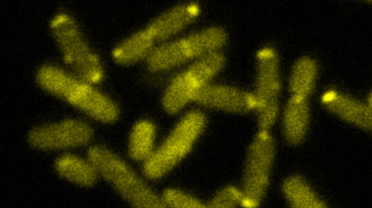 ImageJ=1.48v unit=micron min=24.0 max=279.0